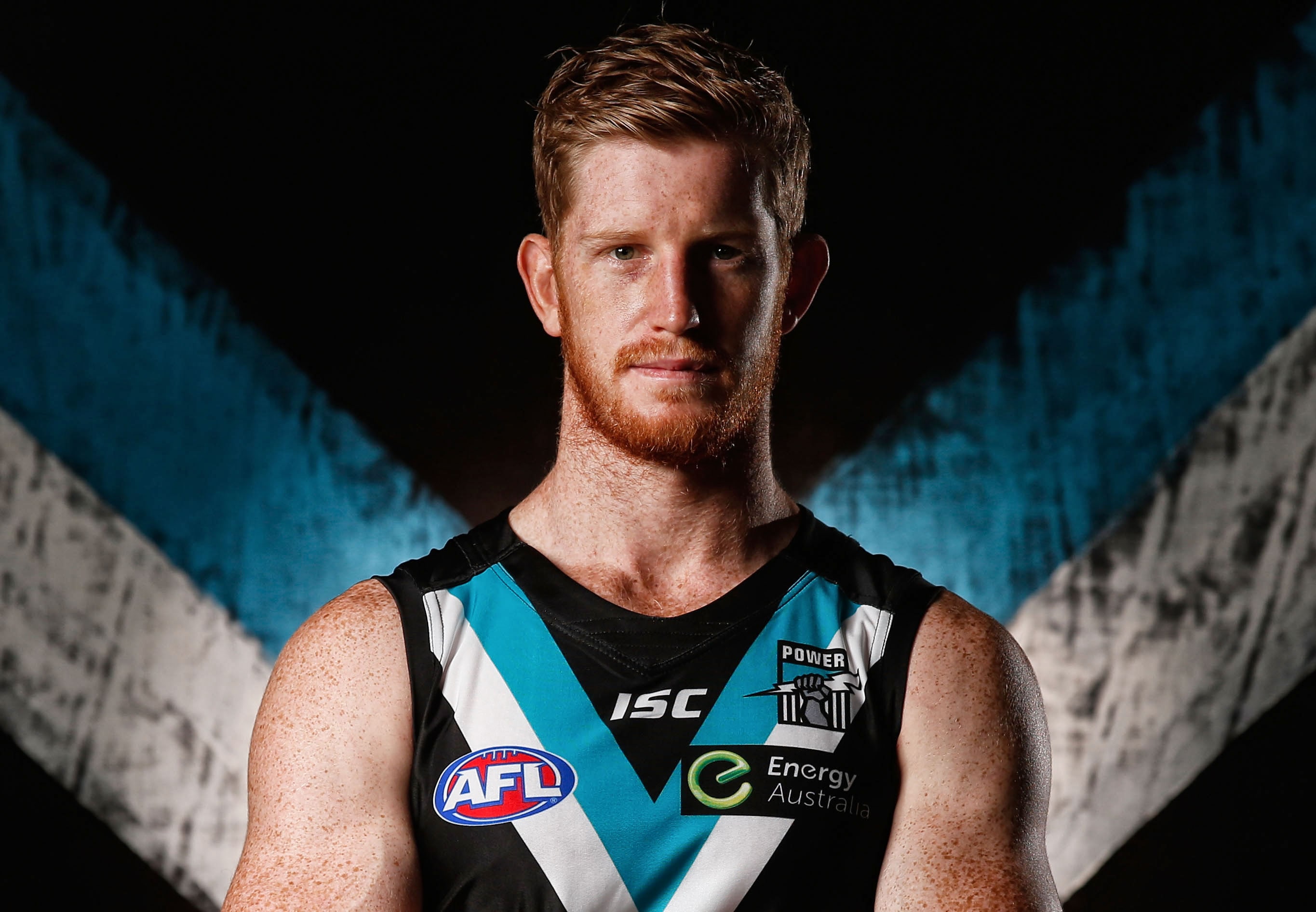 Scans confirm ruptured PCL for Power ruckman